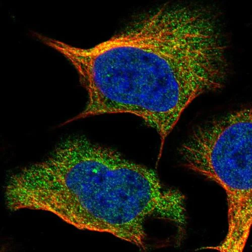 Immunocytochemistry/ Immunofluorescence - Anti- Interferon alpha/beta receptor 1 antibody (AB244357)
