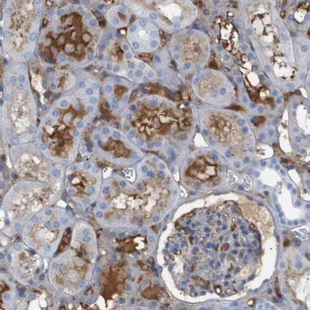 Immunohistochemistry (Formalin/PFA-fixed paraffin-embedded sections) - Anti- Interferon alpha/beta receptor 1 antibody (AB244357)