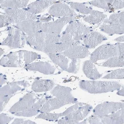 Immunohistochemistry (Formalin/PFA-fixed paraffin-embedded sections) - Anti- Interferon alpha/beta receptor 1 antibody (AB244357)
