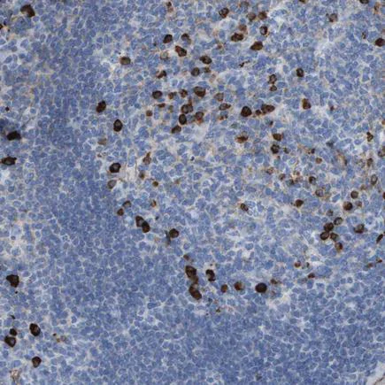 Immunohistochemistry (Formalin/PFA-fixed paraffin-embedded sections) - Anti- Interferon alpha/beta receptor 1 antibody (AB244357)