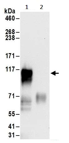 Immunoprecipitation - Anti-Interferon alpha/beta receptor 1 antibody (AB245367)