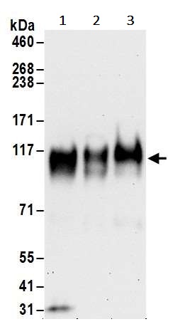 Western blot - Anti-Interferon alpha/beta receptor 1 antibody (AB245367)