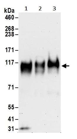 Western blot - Anti-Interferon alpha/beta receptor 1 antibody (AB245367)