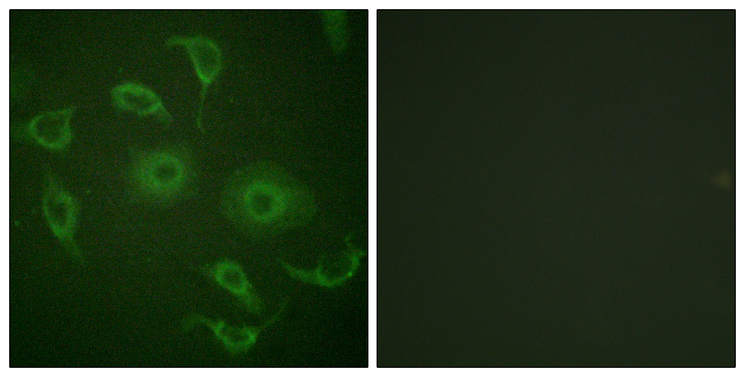 Immunofluorescence - Anti-Interferon alpha/beta receptor 1 antibody (AB62693), expandable thumbnail