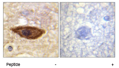 Immunohistochemistry (Formalin/PFA-fixed paraffin-embedded sections) - Anti-Interferon alpha/beta receptor 1 antibody (AB62693), expandable thumbnail