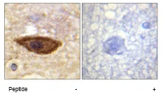Immunohistochemistry (Formalin/PFA-fixed paraffin-embedded sections) - Anti-Interferon alpha/beta receptor 1 antibody (AB62693)