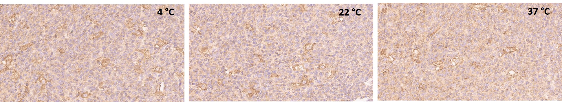 Immunohistochemistry (Formalin/PFA-fixed paraffin-embedded sections) - Anti-Interferon alpha/beta receptor 1 antibody [EPR6244] (AB124764)