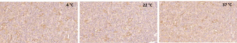 Immunohistochemistry (Formalin/PFA-fixed paraffin-embedded sections) - Anti-Interferon alpha/beta receptor 1 antibody [EPR6244] (AB124764)