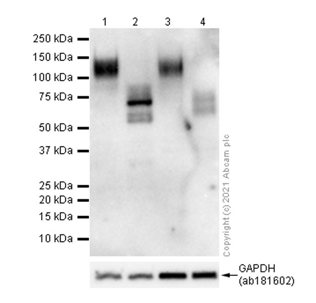 Anti-Interferon alpha/beta receptor 1 antibody [EPR6244]