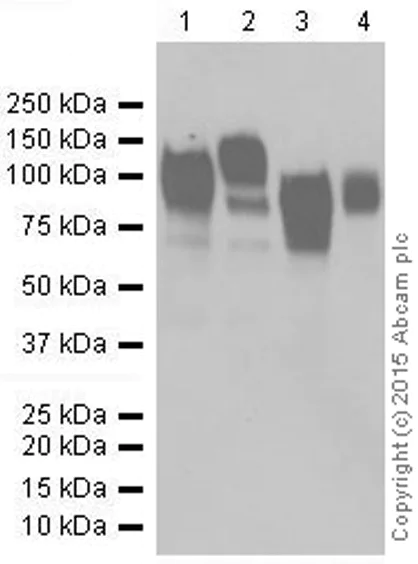 Western blot - Anti-Interferon alpha/beta receptor 1 antibody [EPR6244] (AB124764)