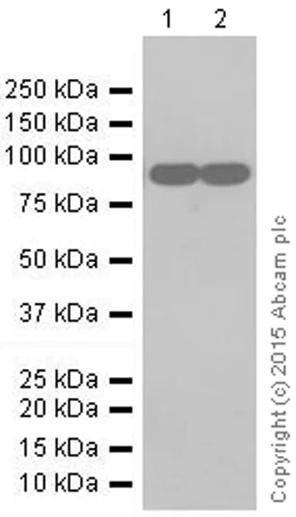 Western blot - Anti-Interferon alpha/beta receptor 1 antibody [EPR6244] (AB124764)