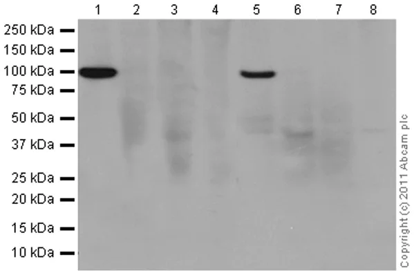 Western blot - Anti-Interferon alpha/beta receptor 1 antibody [EPR6244] (AB124764)
