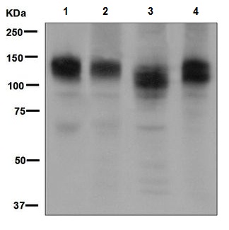 Western blot - Anti-Interferon alpha/beta receptor 1 antibody [EPR6244] (AB124764)