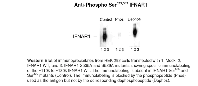 Western blot - Anti-Interferon alpha/beta receptor 1 (phospho S535 + S539) antibody (AB30571)