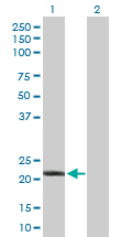 Western blot - Anti-Interferon alpha10 antibody (AB168413), expandable thumbnail