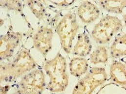 Immunohistochemistry (Formalin/PFA-fixed paraffin-embedded sections) - Anti-Interferon alpha10 antibody (AB236586)