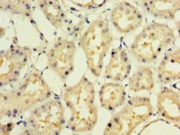 Immunohistochemistry (Formalin/PFA-fixed paraffin-embedded sections) - Anti-Interferon alpha10 antibody (AB236586)