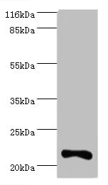Western blot - Anti-Interferon alpha10 antibody (AB236586)
