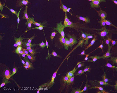 Immunocytochemistry/ Immunofluorescence - Anti-Interferon beta antibody (AB85803)