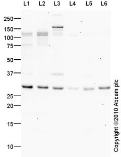 Western blot - Anti-Interferon beta antibody (AB85803)