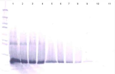 Western blot - Anti-Interferon beta antibody - C-terminal (AB186669), expandable thumbnail