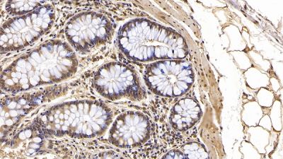 Immunohistochemistry (Formalin/PFA-fixed paraffin-embedded sections) - Anti-Interferon beta antibody [C5] (AB238675)