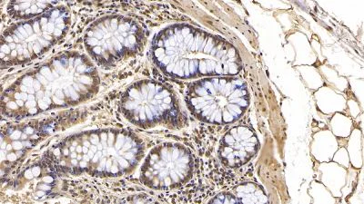 Immunohistochemistry (Formalin/PFA-fixed paraffin-embedded sections) - Anti-Interferon beta antibody [C5] (AB238675)