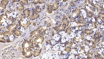 Immunohistochemistry (Formalin/PFA-fixed paraffin-embedded sections) - Anti-Interferon beta antibody [C5] (AB238675)