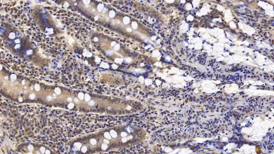 Immunohistochemistry (Formalin/PFA-fixed paraffin-embedded sections) - Anti-Interferon beta antibody [C5] (AB238675)