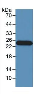 Western blot - Anti-Interferon beta antibody [C5] (AB238675)