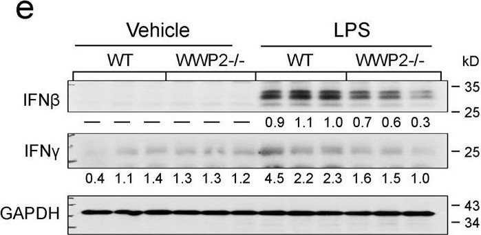 Western blot - Anti-Interferon beta antibody [EPR22186-266] (AB218229)