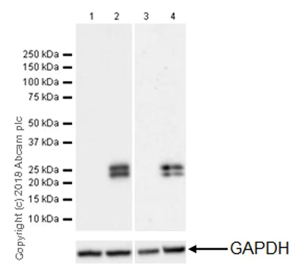 Western blot - Anti-Interferon beta antibody [EPR22186-266] - BSA and Azide free (AB238652)