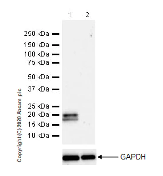 Western blot - Anti-Interferon beta antibody [EPR23341-7] (AB275880)