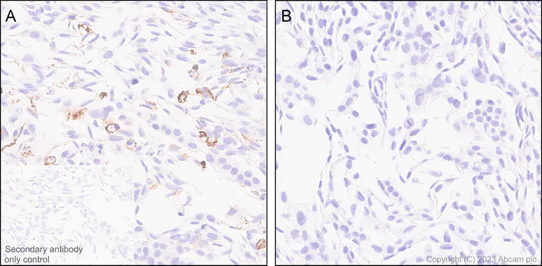 Immunohistochemistry (Formalin/PFA-fixed paraffin-embedded sections) - Anti-Interferon beta antibody [EPR25257-135] (AB309342)