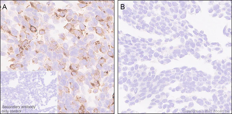 Immunohistochemistry (Formalin/PFA-fixed paraffin-embedded sections) - Anti-Interferon beta antibody [EPR25257-135] (AB309342)