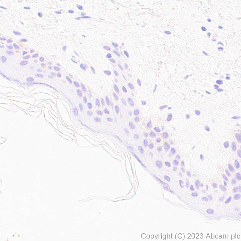 Immunohistochemistry (Formalin/PFA-fixed paraffin-embedded sections) - Anti-Interferon beta antibody [EPR25257-135] (AB309342)