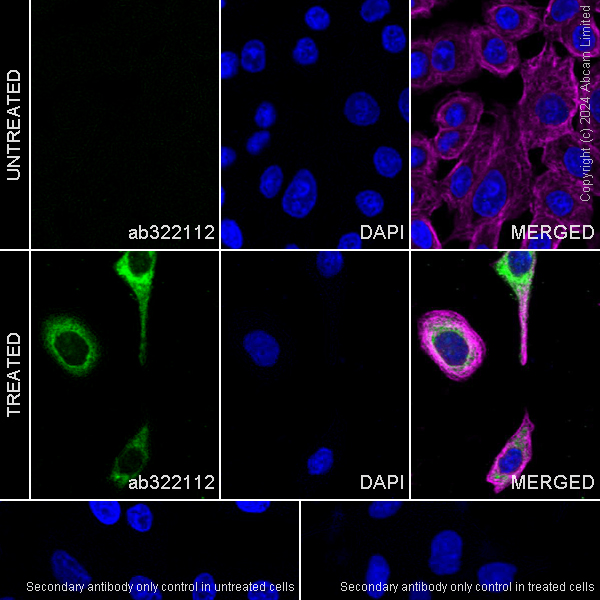 Immunocytochemistry/ Immunofluorescence - Anti-Interferon beta antibody [RM1226] (ab322112), expandable thumbnail