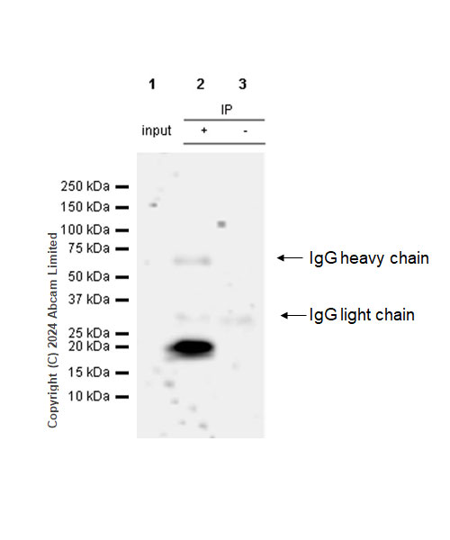 Immunoprecipitation - Anti-Interferon beta antibody [RM1226] (AB322112), expandable thumbnail