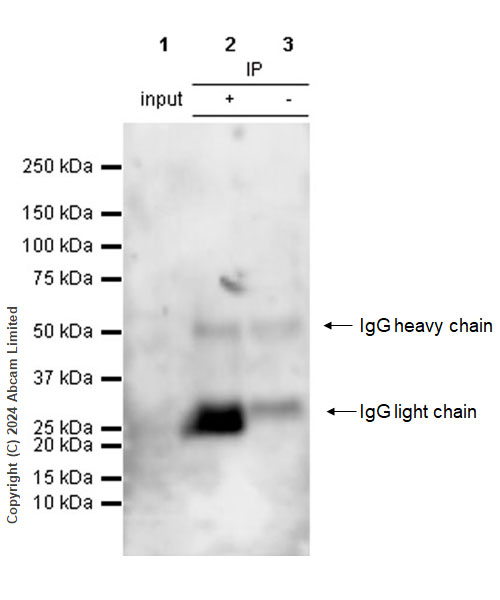 Immunoprecipitation - Anti-Interferon beta antibody [RM1226] (AB322112), expandable thumbnail
