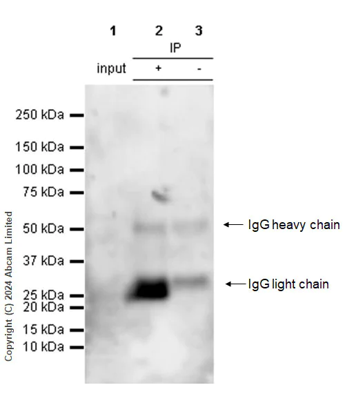 Immunoprecipitation - Anti-Interferon beta antibody [RM1226] (AB322112)