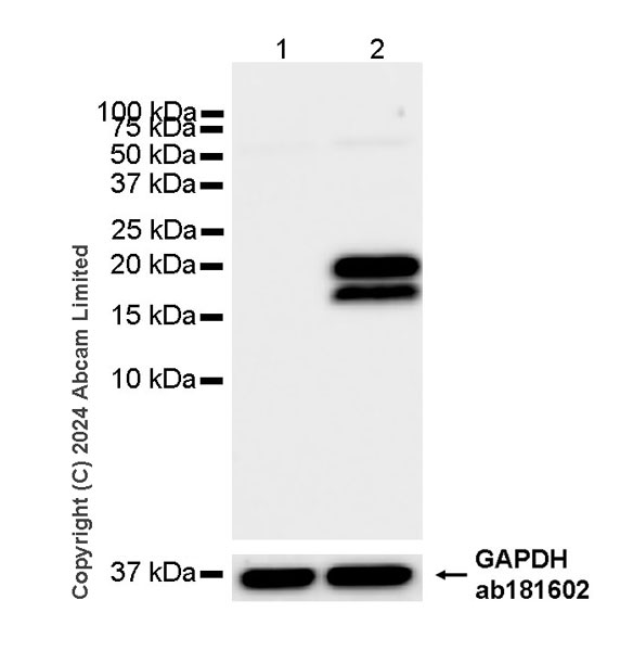 Western blot - Anti-Interferon beta antibody [RM1226] (AB322112), expandable thumbnail
