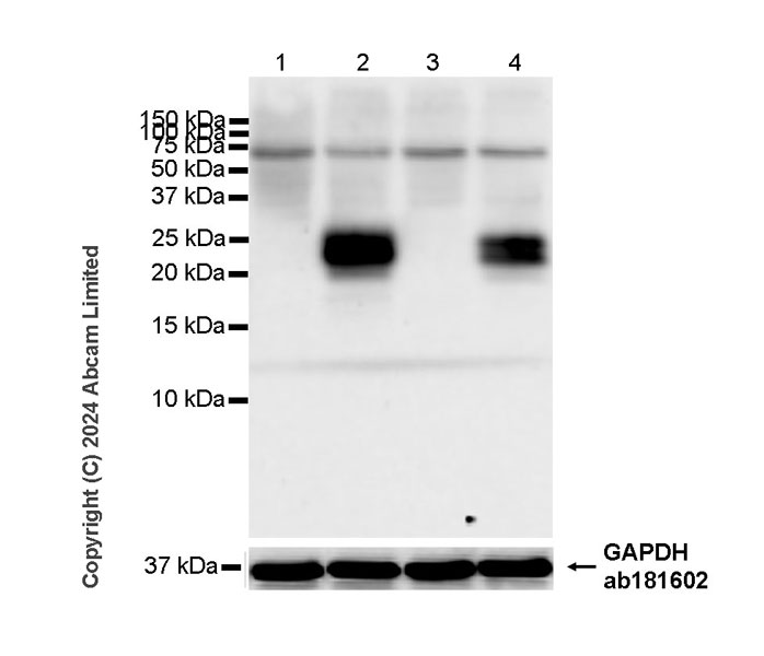 Western blot - Anti-Interferon beta antibody [RM1226] (AB322112), expandable thumbnail