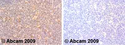 Immunohistochemistry (Formalin/PFA-fixed paraffin-embedded sections) - Anti-Interferon gamma antibody (AB25101)