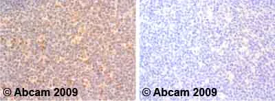 Immunohistochemistry (Formalin/PFA-fixed paraffin-embedded sections) - Anti-Interferon gamma antibody (AB25101)