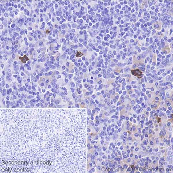 Immunohistochemistry (Formalin/PFA-fixed paraffin-embedded sections) - Anti-Interferon gamma antibody [EPR21704] (AB231036)