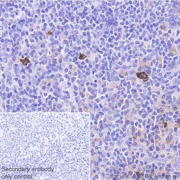 Immunohistochemistry (Formalin/PFA-fixed paraffin-embedded sections) - Anti-Interferon gamma antibody [EPR21704] (AB231036)