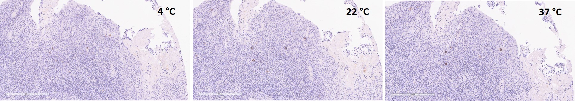 Immunohistochemistry (Formalin/PFA-fixed paraffin-embedded sections) - Anti-Interferon gamma antibody [EPR21704] (AB231036)