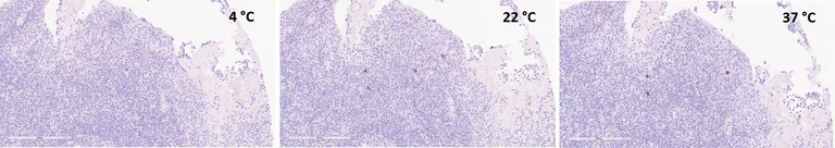 Immunohistochemistry (Formalin/PFA-fixed paraffin-embedded sections) - Anti-Interferon gamma antibody [EPR21704] (AB231036)
