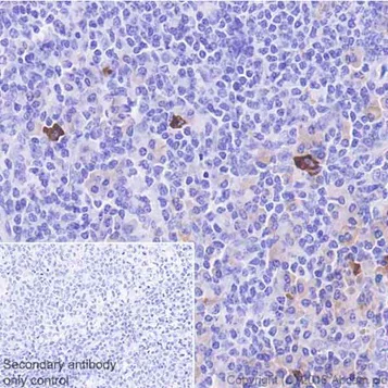 Immunohistochemistry (Formalin/PFA-fixed paraffin-embedded sections) - Anti-Interferon gamma antibody [EPR21704] - BSA and Azide free (AB231301)
