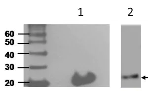 Western blot - Anti-Interferon gamma antibody [N3-P3A5*A10] (AB211784)